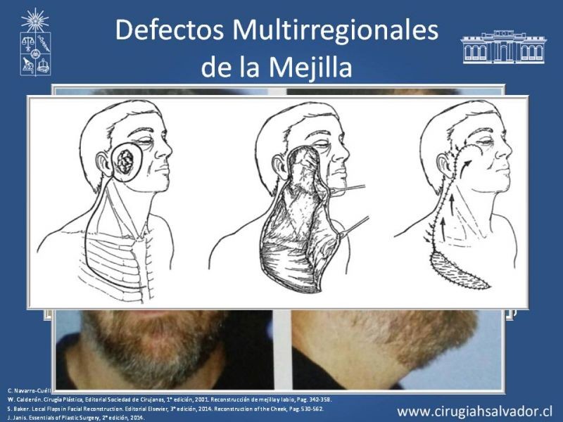 Diapositiva 61 de Reconstrucción peribucal