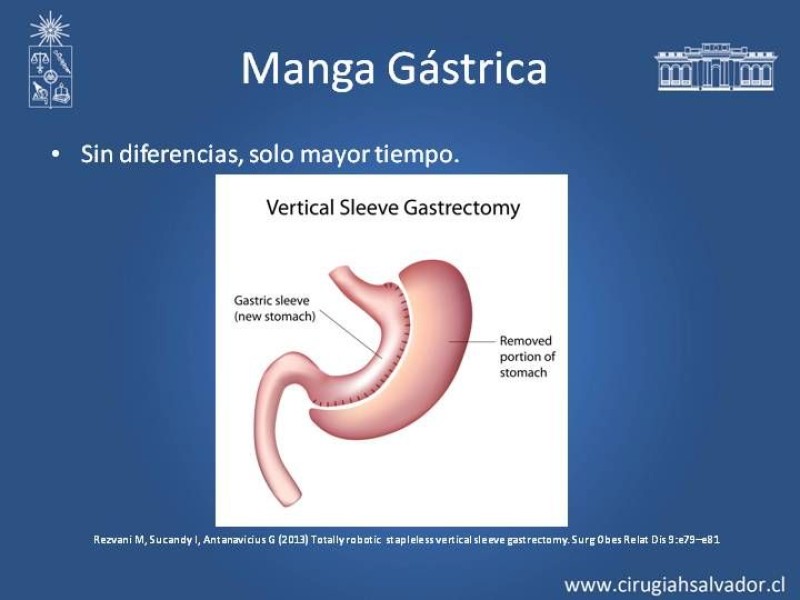 Diapositiva 15 de Robótica en Cirugía Digestiva y Bariátrica