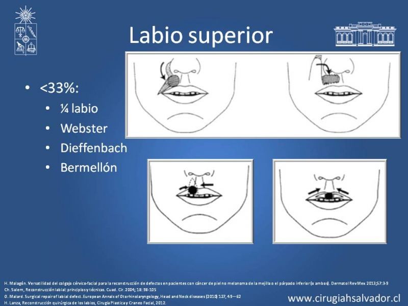 Diapositiva 10 de Reconstrucción peribucal
