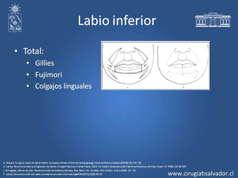 Diapositiva 17 de Reconstrucción peribucal