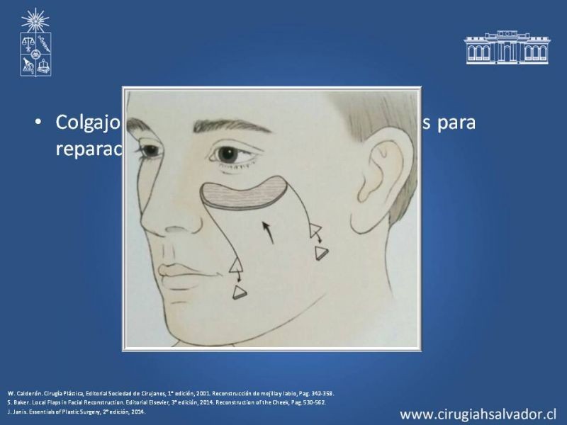 Diapositiva 35 de Reconstrucción peribucal