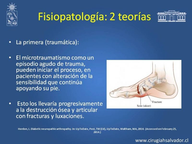 Diapositiva 5 de Diagnostico y manejo de artropatia de Charcot