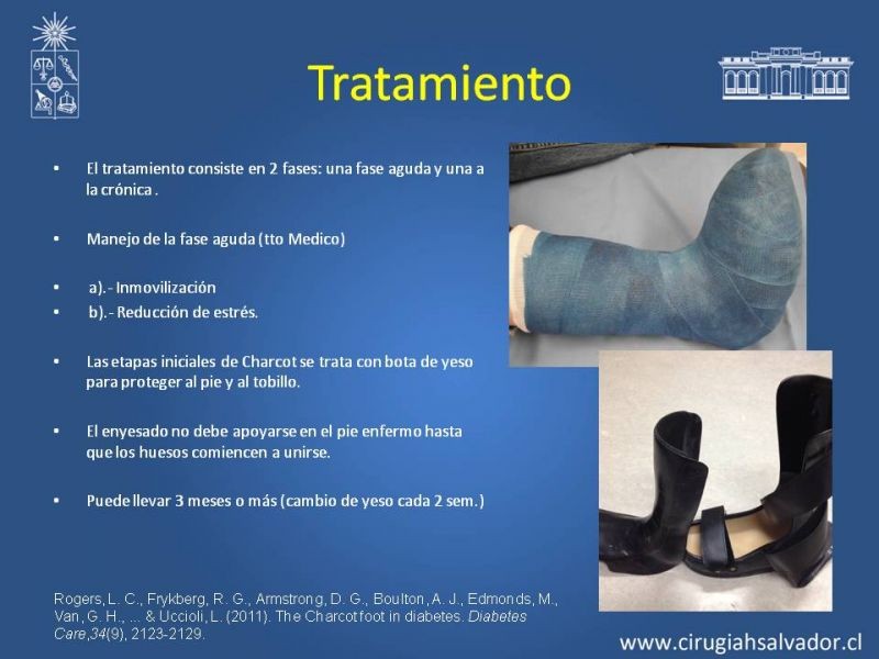Diapositiva 23 de Diagnostico y manejo de artropatia de Charcot