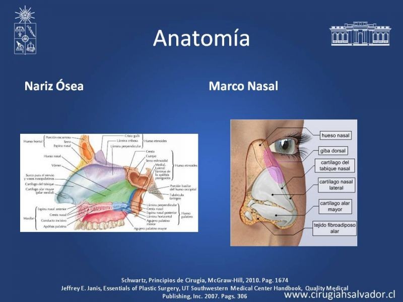 Diapositiva 3 de Reconstrucción Nasal