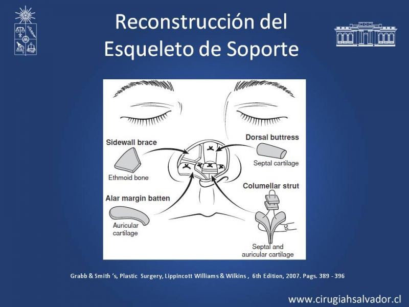 Diapositiva 28 de Reconstrucción Nasal