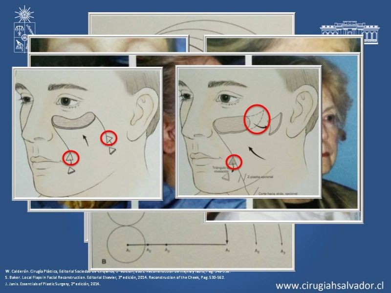 Diapositiva 39 de Reconstrucción peribucal