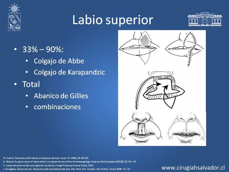 Diapositiva 12 de Reconstrucción peribucal