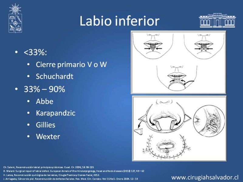 Diapositiva 15 de Reconstrucción peribucal