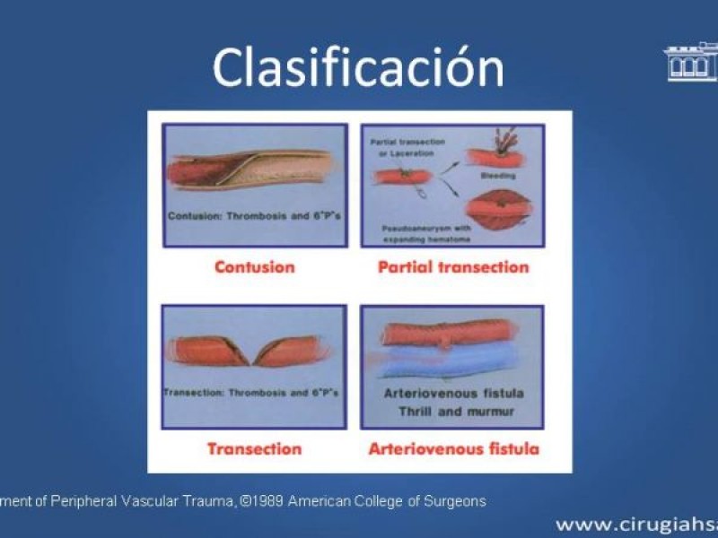 Diapositiva 8 de Trauma Vascular: Extremidades inferiores