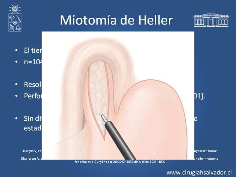 Diapositiva 9 de Robótica en Cirugía Digestiva y Bariátrica