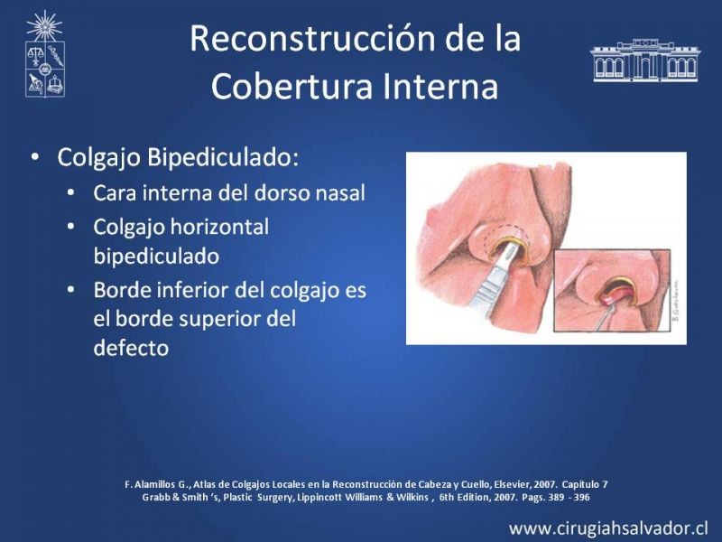 Diapositiva 33 de Reconstrucción Nasal