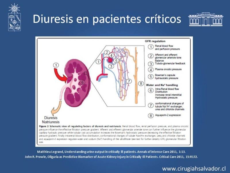 Diapositiva 8 de Manejo de la Oliguria