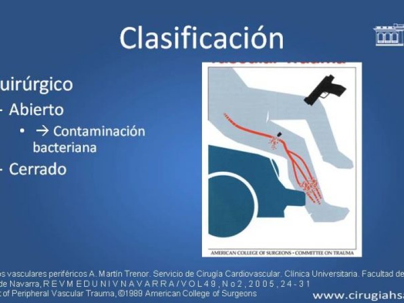 Diapositiva 4 de Trauma Vascular: Extremidades inferiores