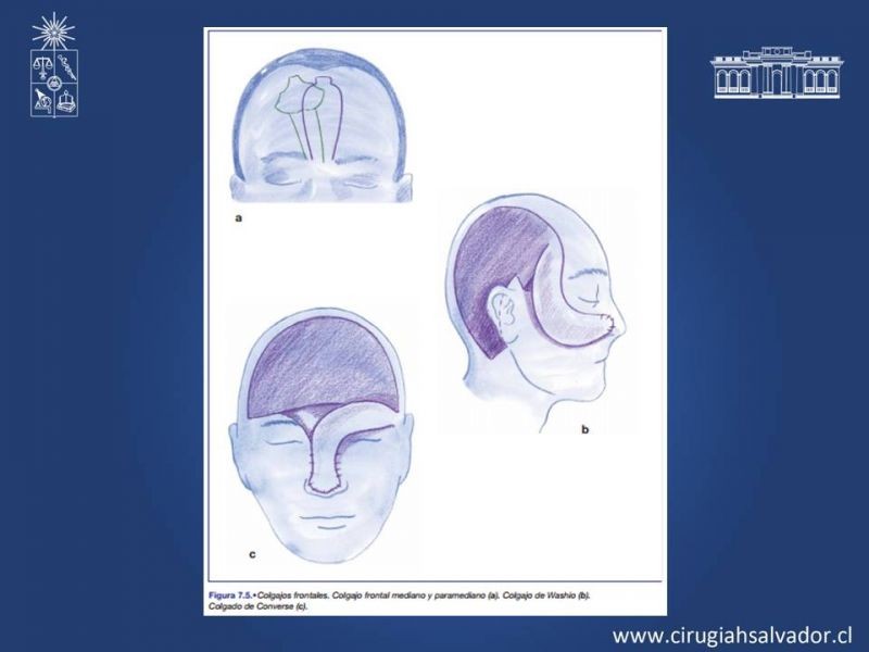 Diapositiva 22 de Reconstrucción Nasal