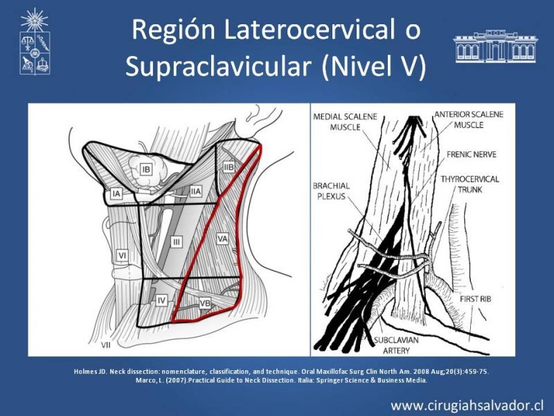 Diapositiva 29 de Técnica quirúrgica en disección cervical radical modificada