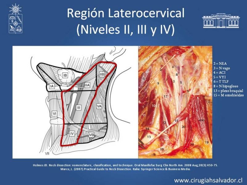 Diapositiva 19 de Técnica quirúrgica en disección cervical radical modificada