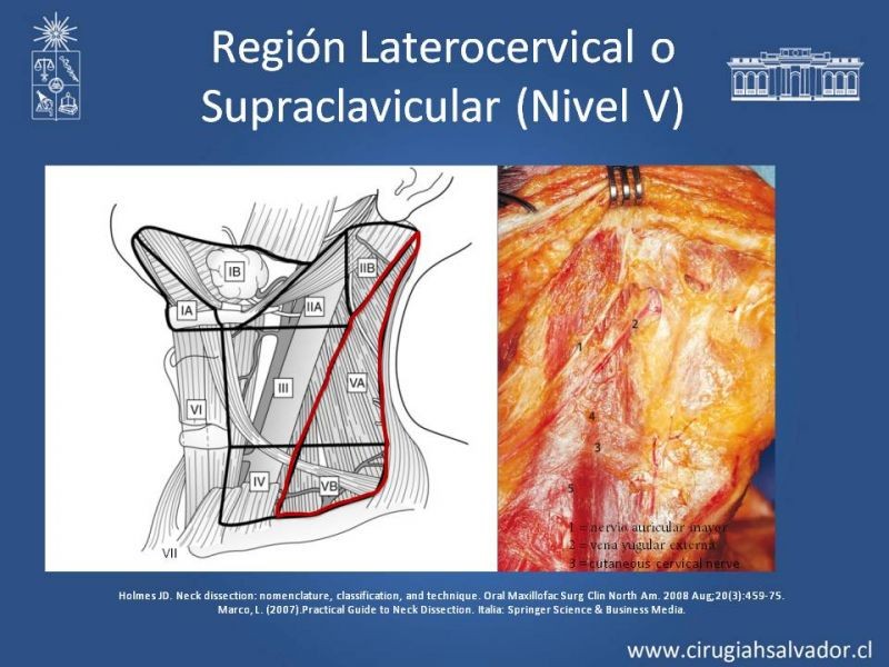Diapositiva 25 de Técnica quirúrgica en disección cervical radical modificada