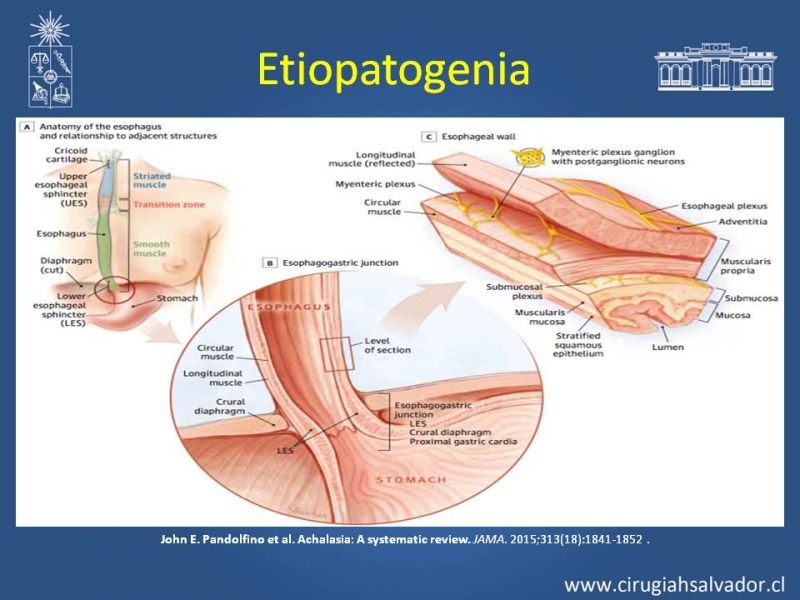Diapositiva 4 de Manejo Acalasia