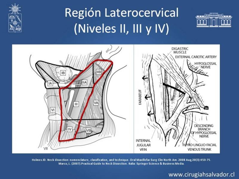 Diapositiva 17 de Técnica quirúrgica en disección cervical radical modificada