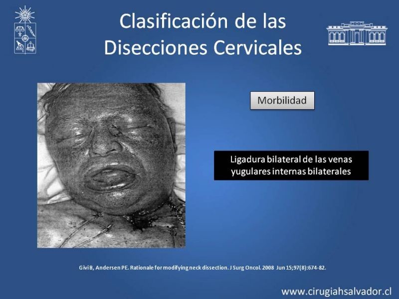 Diapositiva 38 de Técnica quirúrgica en disección cervical radical modificada