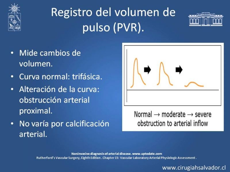 Diapositiva 12 de Laboratorio vascular