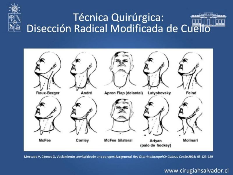 Diapositiva 45 de Técnica quirúrgica en disección cervical radical modificada