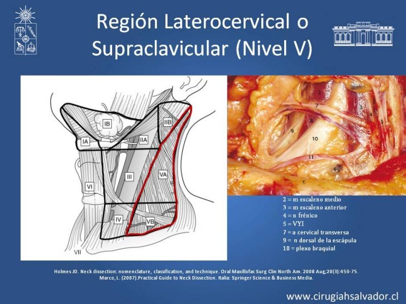 Diapositiva 28 de Técnica quirúrgica en disección cervical radical modificada