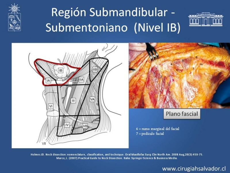 Diapositiva 10 de Técnica quirúrgica en disección cervical radical modificada