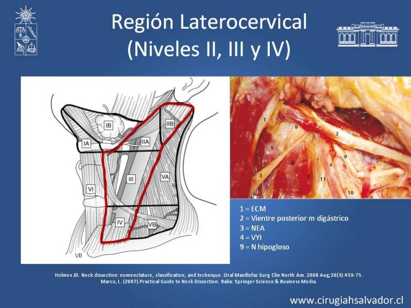 Diapositiva 16 de Técnica quirúrgica en disección cervical radical modificada