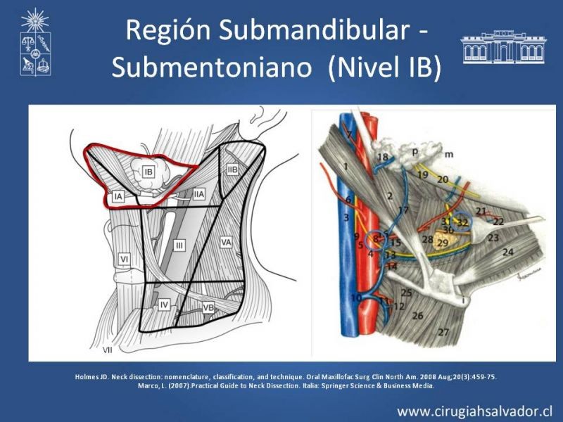 Diapositiva 13 de Técnica quirúrgica en disección cervical radical modificada