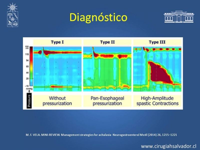 Diapositiva 10 de Manejo Acalasia