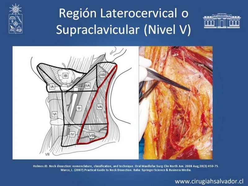 Diapositiva 27 de Técnica quirúrgica en disección cervical radical modificada