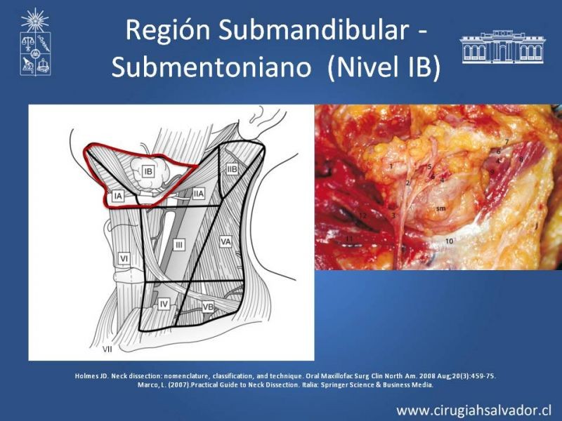Diapositiva 12 de Técnica quirúrgica en disección cervical radical modificada