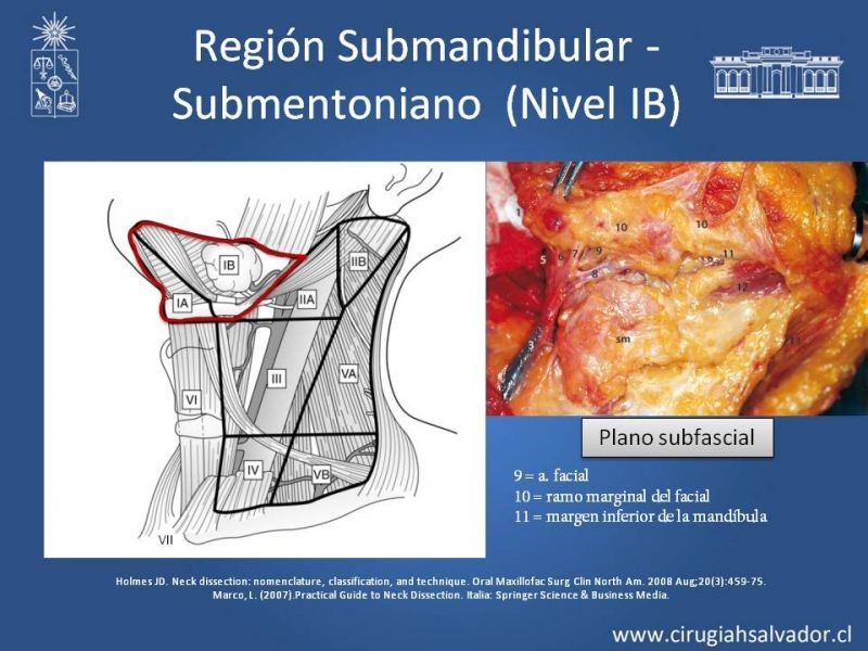 Diapositiva 11 de Técnica quirúrgica en disección cervical radical modificada