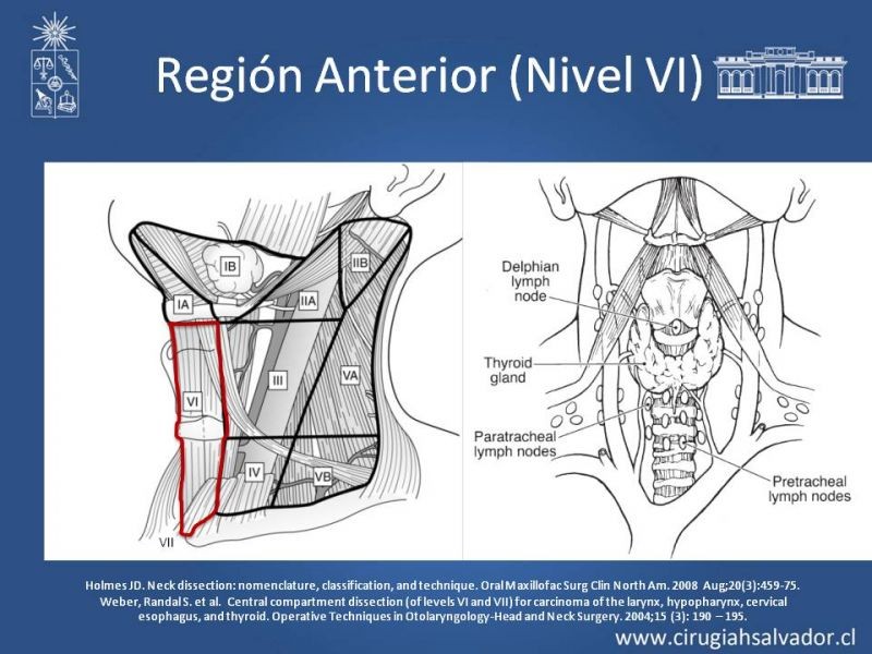 Diapositiva 33 de Técnica quirúrgica en disección cervical radical modificada