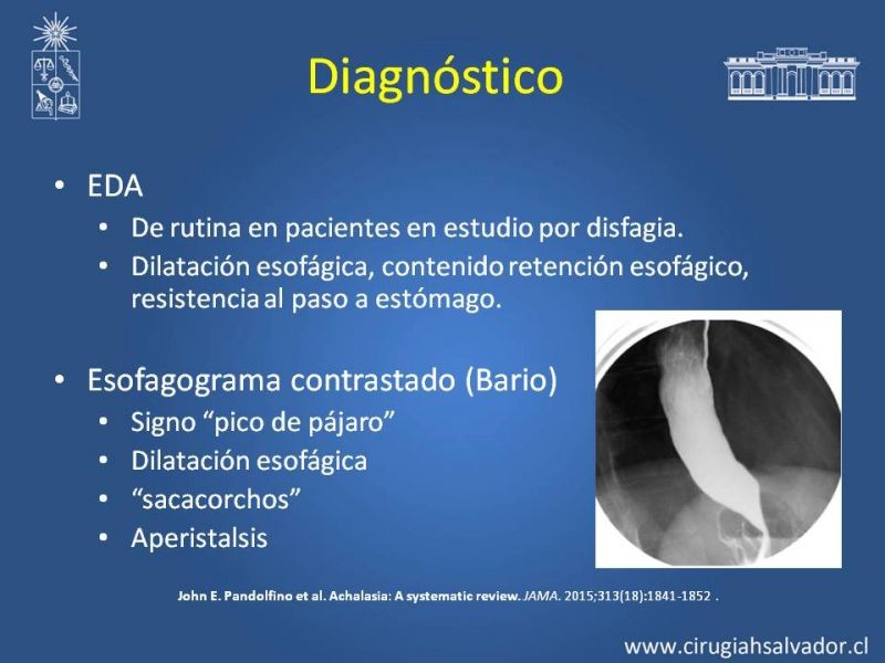 Diapositiva 6 de Manejo Acalasia