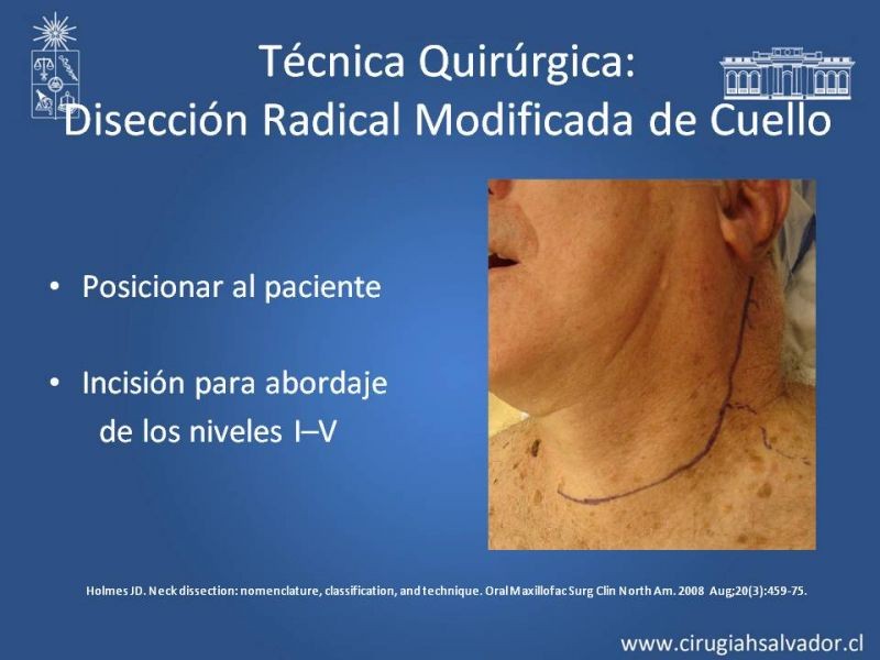 Diapositiva 49 de Técnica quirúrgica en disección cervical radical modificada