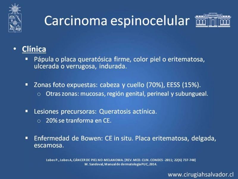 Diapositiva 8 de Cáncer espinocelular y ganglio centinela