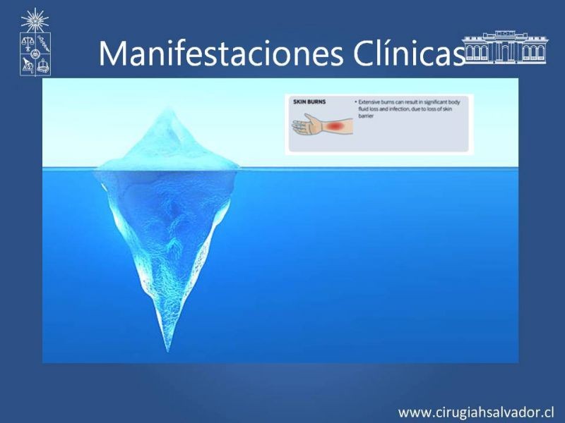 Diapositiva 13 de Quemaduras Eléctricas