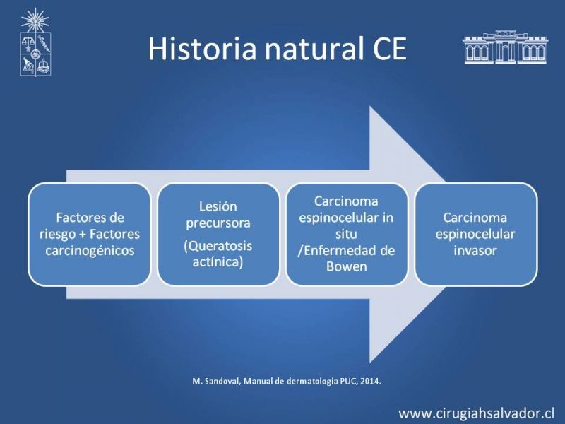 Diapositiva 10 de Cáncer espinocelular y ganglio centinela