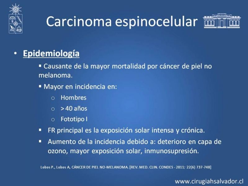 Diapositiva 5 de Cáncer espinocelular y ganglio centinela