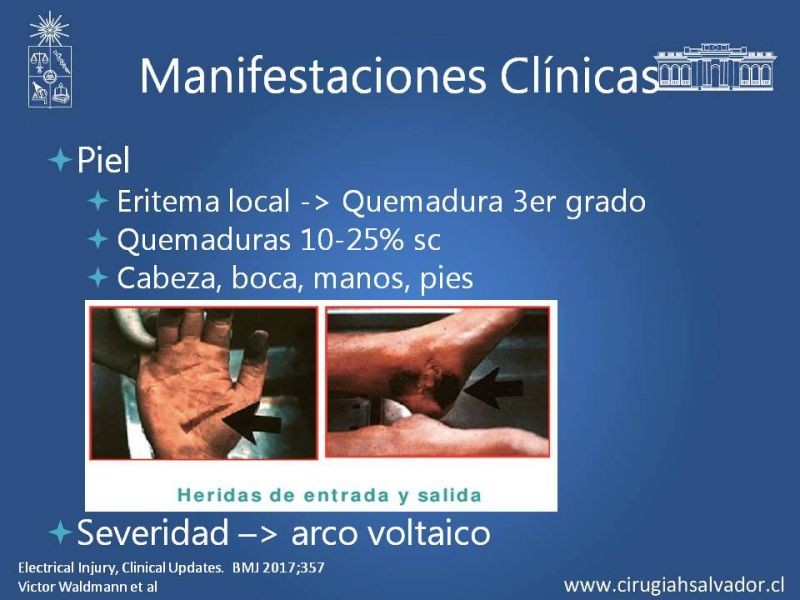 Diapositiva 15 de Quemaduras Eléctricas