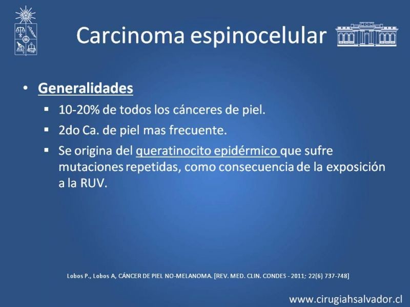 Diapositiva 4 de Cáncer espinocelular y ganglio centinela
