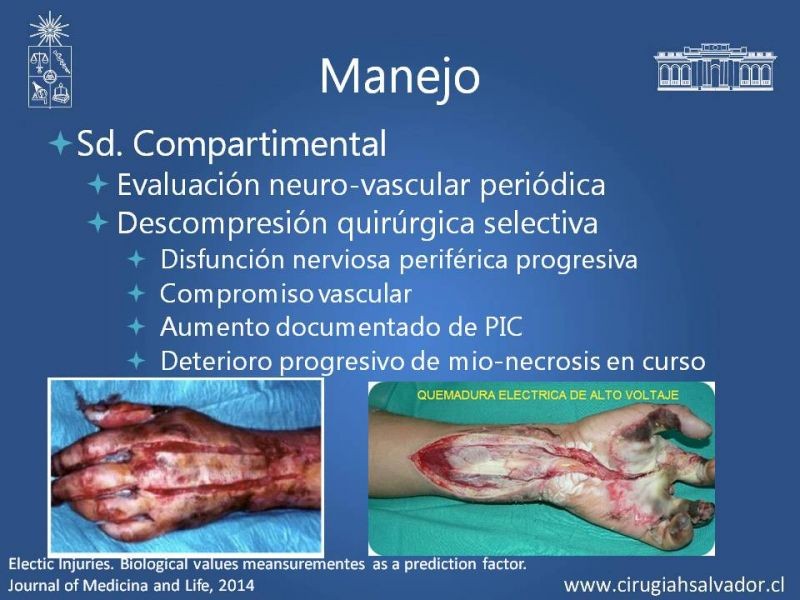 Diapositiva 23 de Quemaduras Eléctricas