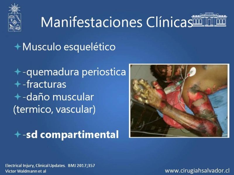 Diapositiva 19 de Quemaduras Eléctricas