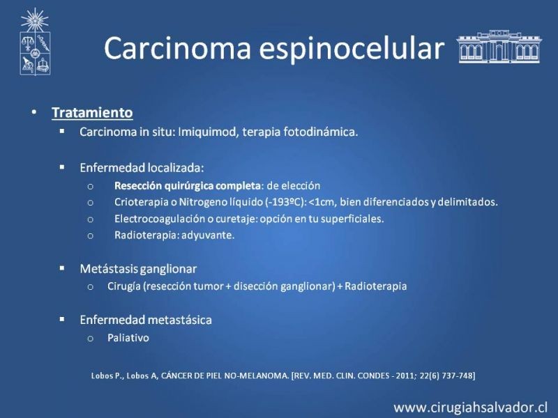 Diapositiva 13 de Cáncer espinocelular y ganglio centinela