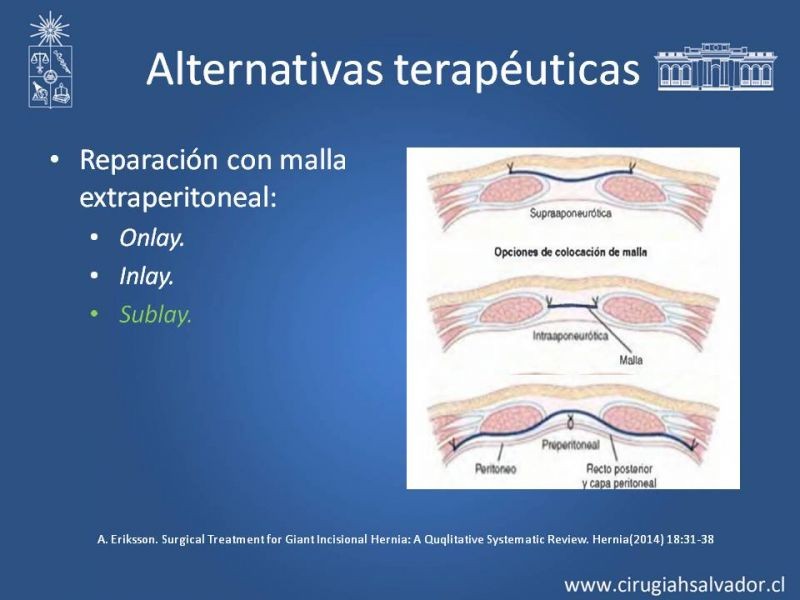 Diapositiva 4 de Hernias Ventrales / Incisionales y Obesidad