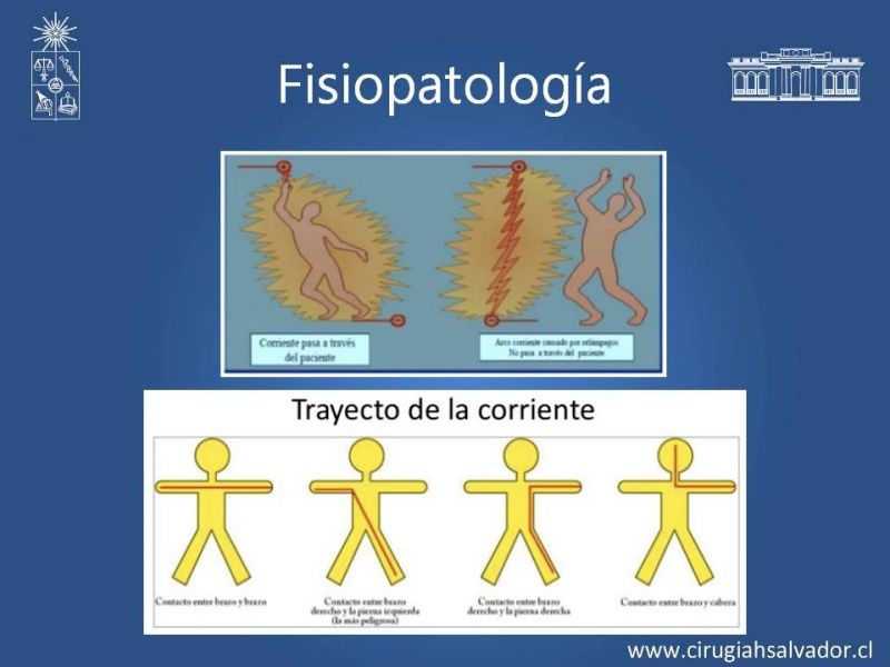 Diapositiva 10 de Quemaduras Eléctricas