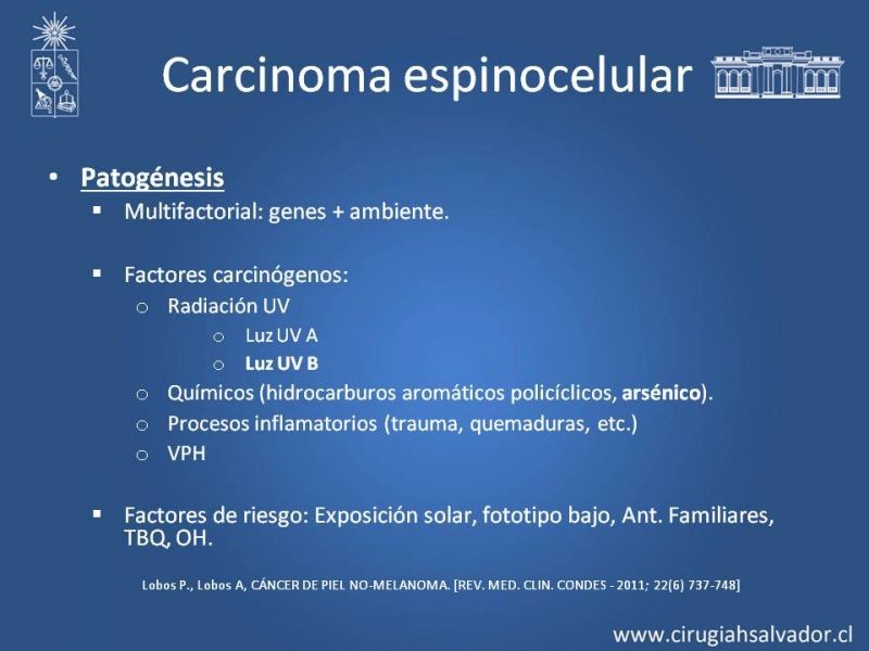 Diapositiva 6 de Cáncer espinocelular y ganglio centinela