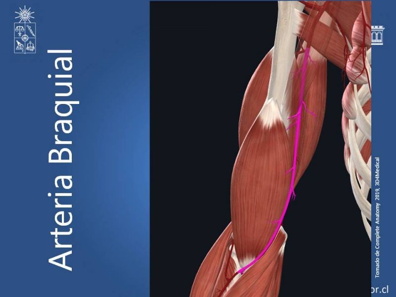 Diapositiva 10 de Anatomía quirúrgica y accesos vasculares: Arteria axilar, braquial, radial y ulnar